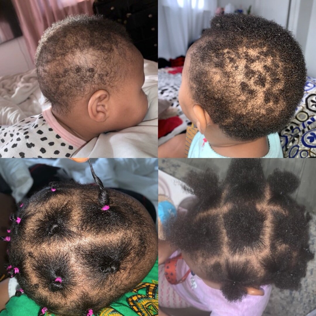 Baby/adult Hair Growth and Strength Oil Infused With Chebe & Ayurvedic