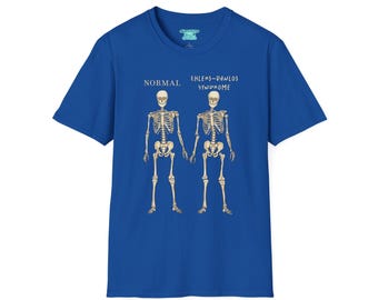 Ehlers-Danlos-Krankheitssyndrom-Bewusstseins-T-Shirt, EDS Unisex Kurzarm-Grafik-T-Shirt, Zebra-Geschenk