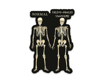 Ehlers Danlos Syndrome Magnet: EDS Awareness Medical Illustration