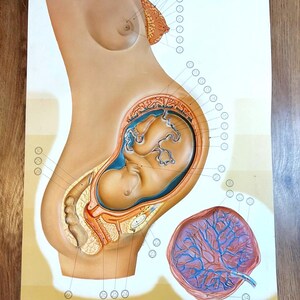 Vintage Anatomie Illustration Schwangerschaft Plastik Poster Medizinisches Dekor