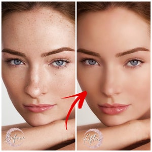 Advenced Face Retouching- Selfie Healing- Remove Skin Defect- Acne Photoshop- Instagram Post Photo Perfecting- Shrink Nose