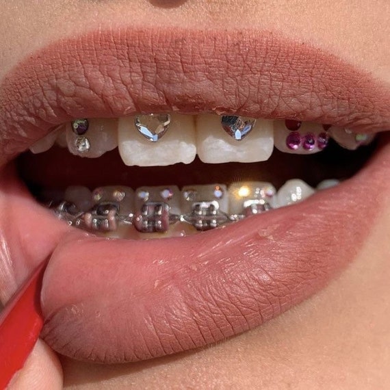 science on Twitter  Pretty teeth, Tooth gem, Teeth jewelry