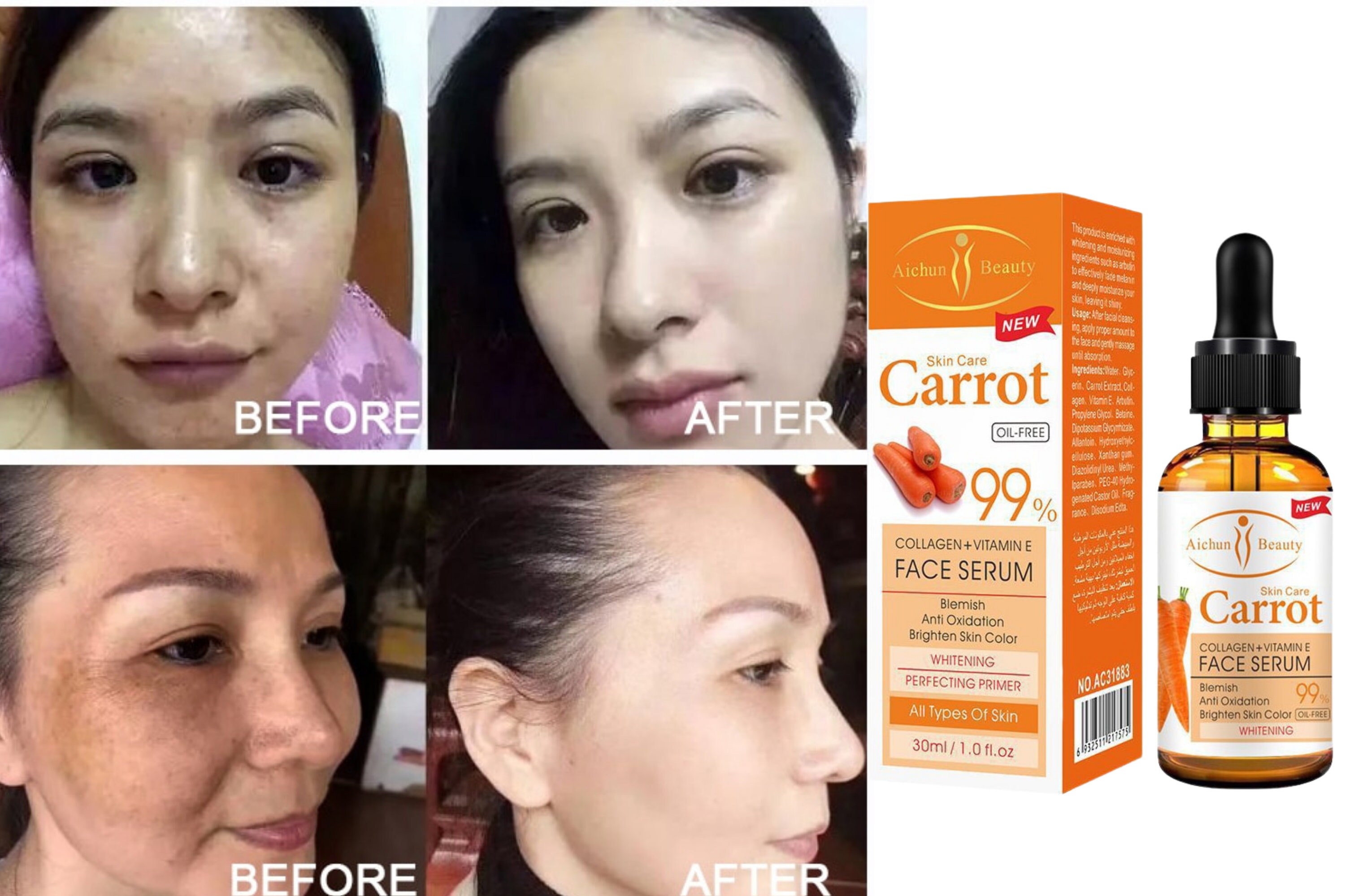 Real Carrot Serum Pigmentation Skincare Dark Spot Remover Etsy