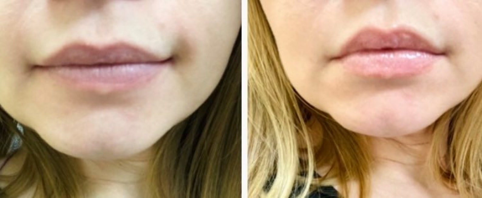 Bee Sting Lip Plumper Natural Lip Enhancement Lip Gloss Etsy