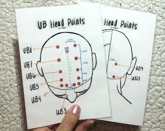 Puntos de cabecera del canal UB