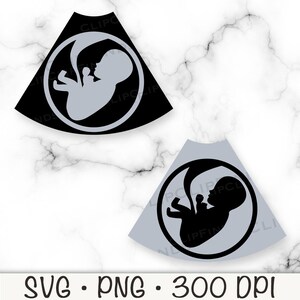 Ecografia del bambino, embrione, feto, SVG, PNG, download digitale istantaneo