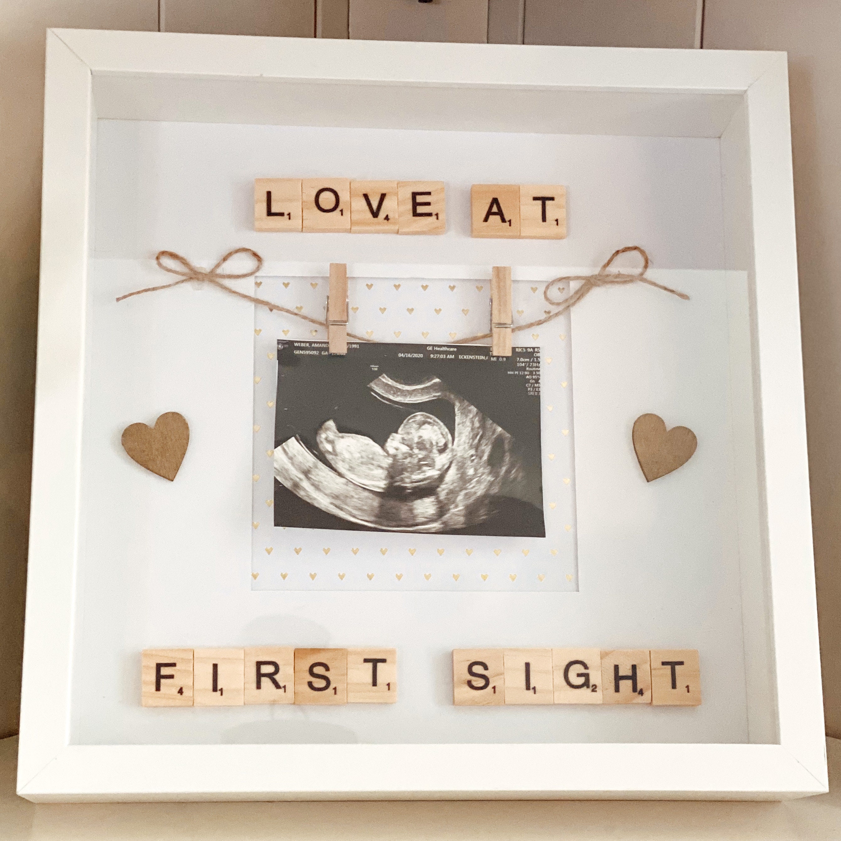 Pregnancy Shadow Box