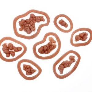 Cyst Growth Pack / Boils / Encapsulated Silicone Prosthetic / Abscess / Blister / Special Effects Makeup