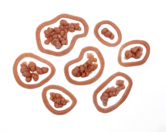 Cyst Growth Pack / Boils / Encapsulated Silicone Prosthetic / Abscess / Blister / Special Effects Makeup