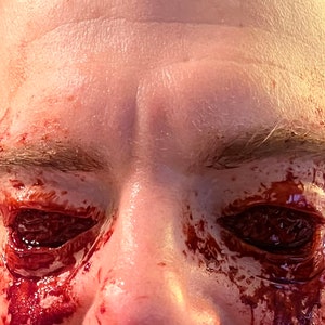 Op de afbeelding: Close-up van een gezicht met bloed dat de ogen bedekt. De ogen zijn volledig bedekt met bloed en de huid rond de ogen is rood en gezwollen.