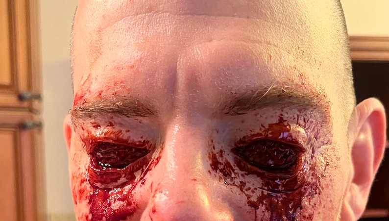 Op de afbeelding: Close-up van een gezicht met bloed dat de ogen bedekt. De ogen zijn volledig bedekt met bloed en de huid rond de ogen is rood en gezwollen.