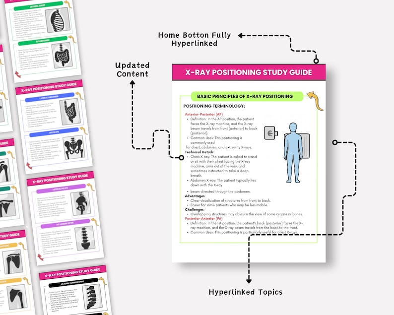 X-ray Positioning Study Guide, Radiography Students, 45+ Positions (PDF ...