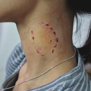 Realistic Human Bite Prosthetic – HUMAN BITE FX | Character Accessory | Halloween Prosthetic | Halloween Cosplay | Makeup Artist Prosthetic