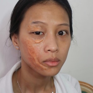 May include: A person's face with makeup applied to simulate a burn injury. The makeup is a mix of orange and brown tones, covering a portion of the cheek and extending towards the eye. The skin tone is light, and the background is a plain white.