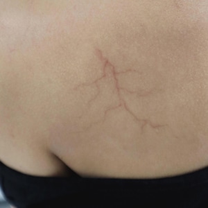 Realistic Veins SFX Temporary Tattoo | Halloween Accessory | Halloween costume | Cosplay | Sfx Makeup | Costume Party |  by DESIRED FX