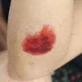 Realistic Bruise Temporary Tattoo Set | Fresh & Healing SFX Wound | 2 Types | Halloween Cosplay Costume | Film Theatre Prop product logo