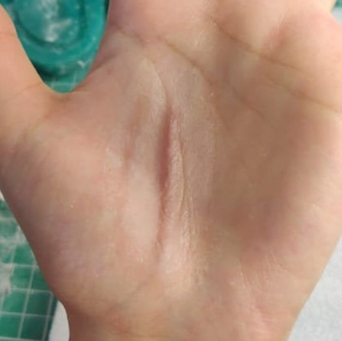 SFX Healed Stab Old Fake Scar Halloween Keloid Etsy