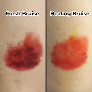 Fake Scar Bruise SFX Temporary Tattoo | Halloween Accessory | Halloween Tattoo | Cosplay | Sfx Makeup | Costume Party | by DESIRED FX