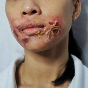 Silicone Rotten Wound Prosthetic: Zombie SFX Makeup, Halloween Cosplay