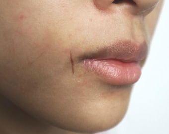 May include: Close-up of a person's face, focusing on the lower portion. The image shows a small, vertical cut on the cheek near the lip. The lips are slightly parted, and the skin tone is a light brown.