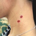 Vampire Bite Wound Temporary Tattoo | Realistic Fake Bite Mark for Halloween and Cosplay | Fake bite wound | Cosplay vampire bite product logo