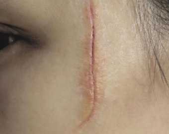 Realistische siliconenprothese voor oud gezicht litteken | Twee soorten | Hulu Disney Netflix | 7 huidskleuren | Verouderd litteken | SFX Make-upfilm TV Halloween