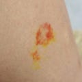 Realistic Old Bruise Temporary Tattoo: SFX Halloween Costume Accessory product logo