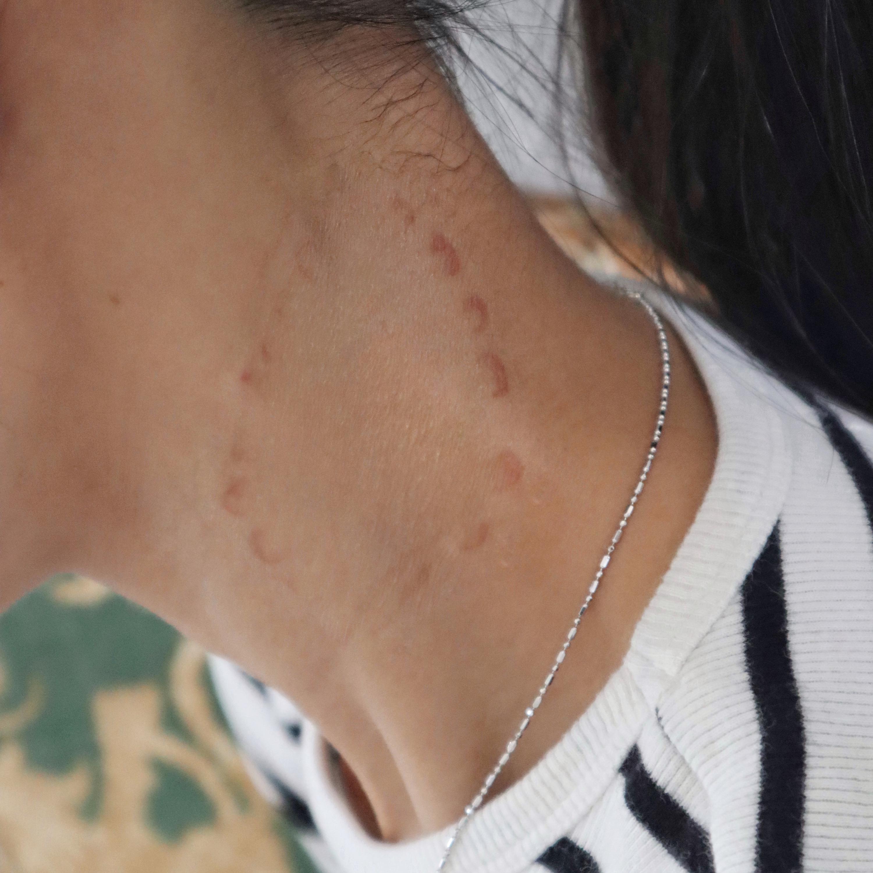 リアルな人間の噛みつきタトゥー｜ハロウィンSFXメイク - Etsy 日本