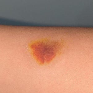 Realistic Bruise SFX Temporary Tattoo | Halloween Accessory | Halloween Tattoo| Cosplay | Sfx Makeup | Costume Party | by DESIRED FX