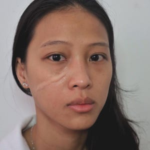 Puede incluir: Retrato en primer plano de una persona con cabello oscuro y ojos marrones. Una cicatriz es visible en la cara de la persona, cerca del ojo. La persona mira directamente a la cámara.