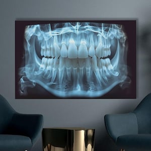 Dental X-Ray Canvas Wall Art, Panoramic Teeth Poster Print, Medical Anatomy Artwork, Dentist Office Decor, Radiology-Inspired Modern Art