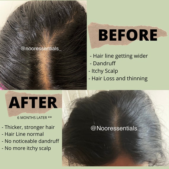 Hair Growing Oil REVIVE Hair Oil Renew Repair Regrow Etsy