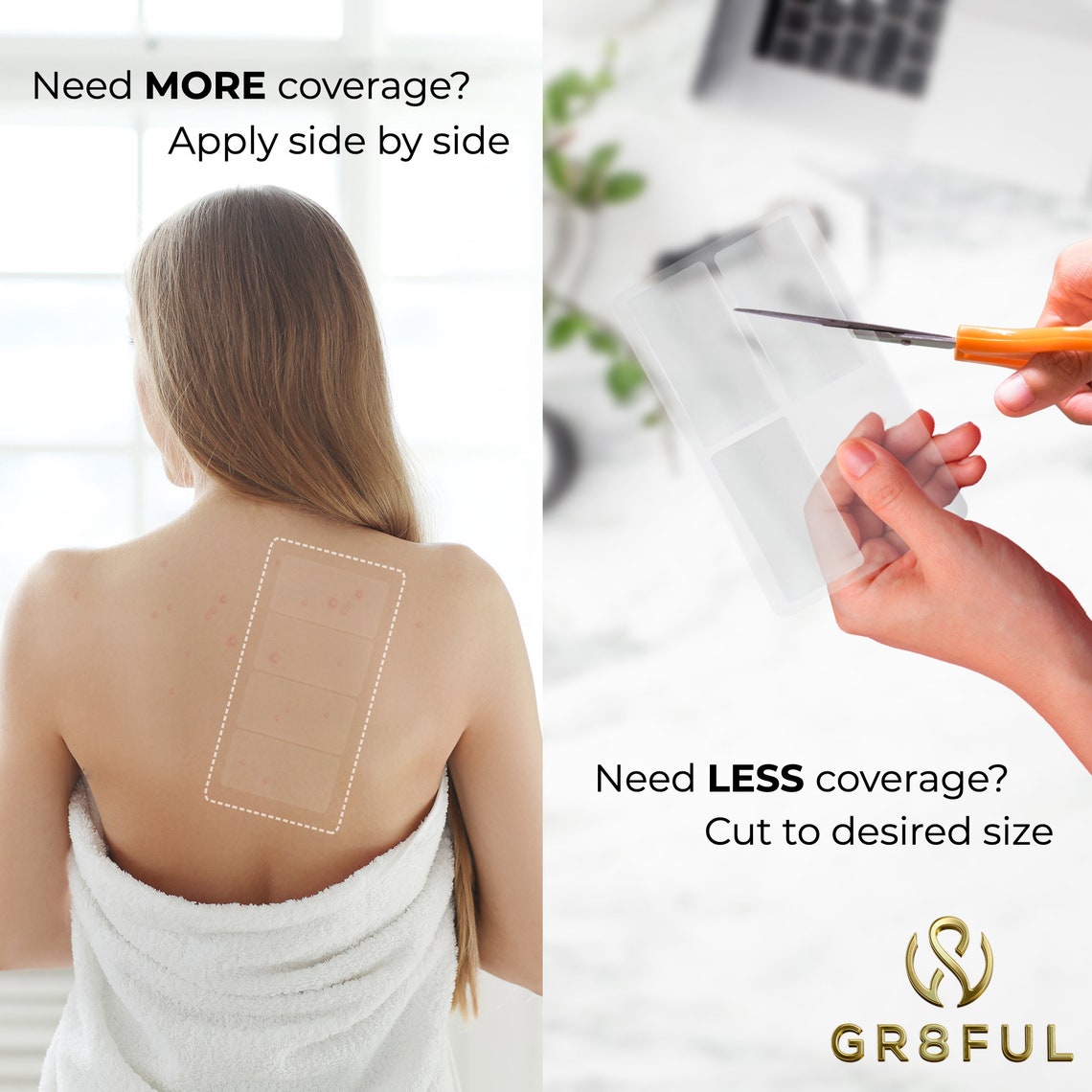 Large Acne Healing Pimple Patch 16 Patches Hydrocolloid Spot Etsy