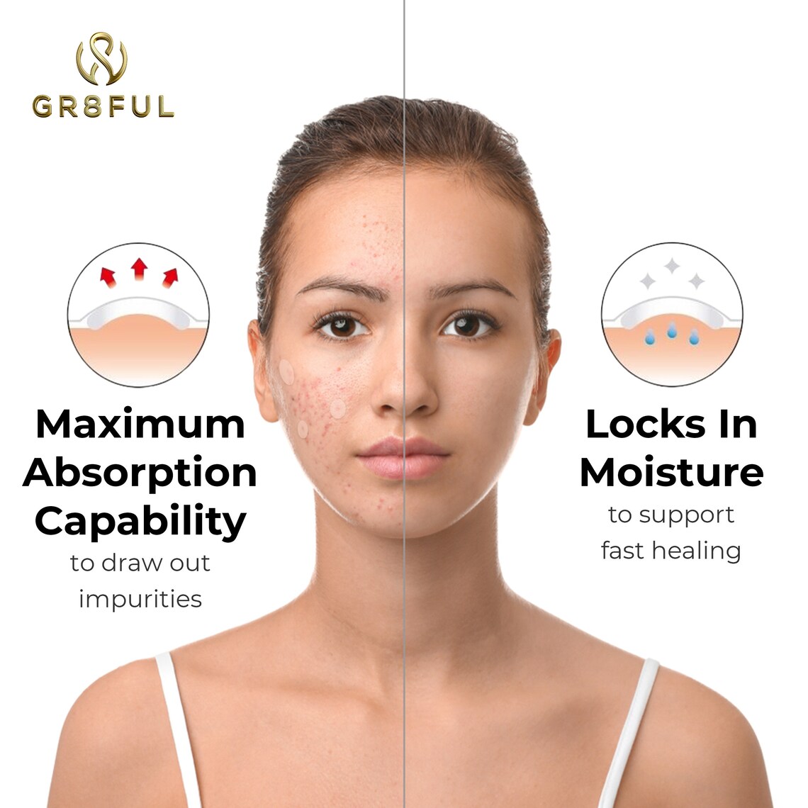 GR8FUL Blemish Healing Acne Pimple Patch 72 Patches Zit Etsy