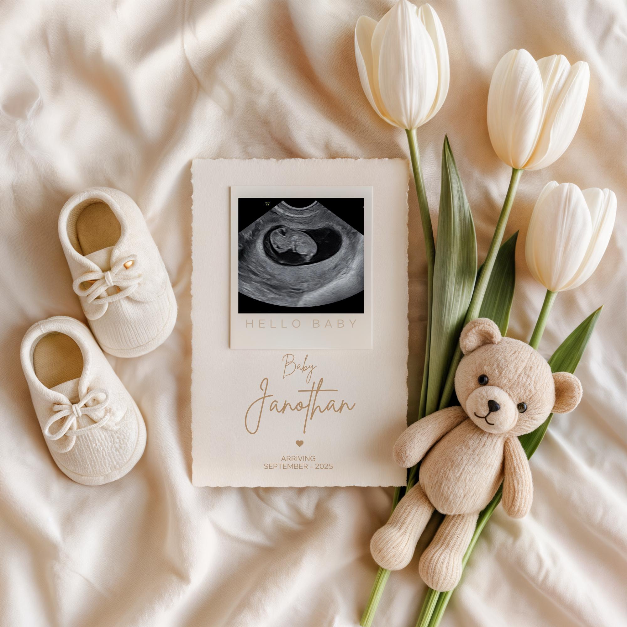 Simple Neutral Pregnancy Announcement Template Digital Baby Announcement Social Media Pregnancy Reveal Editable Canva Pregnancy Template