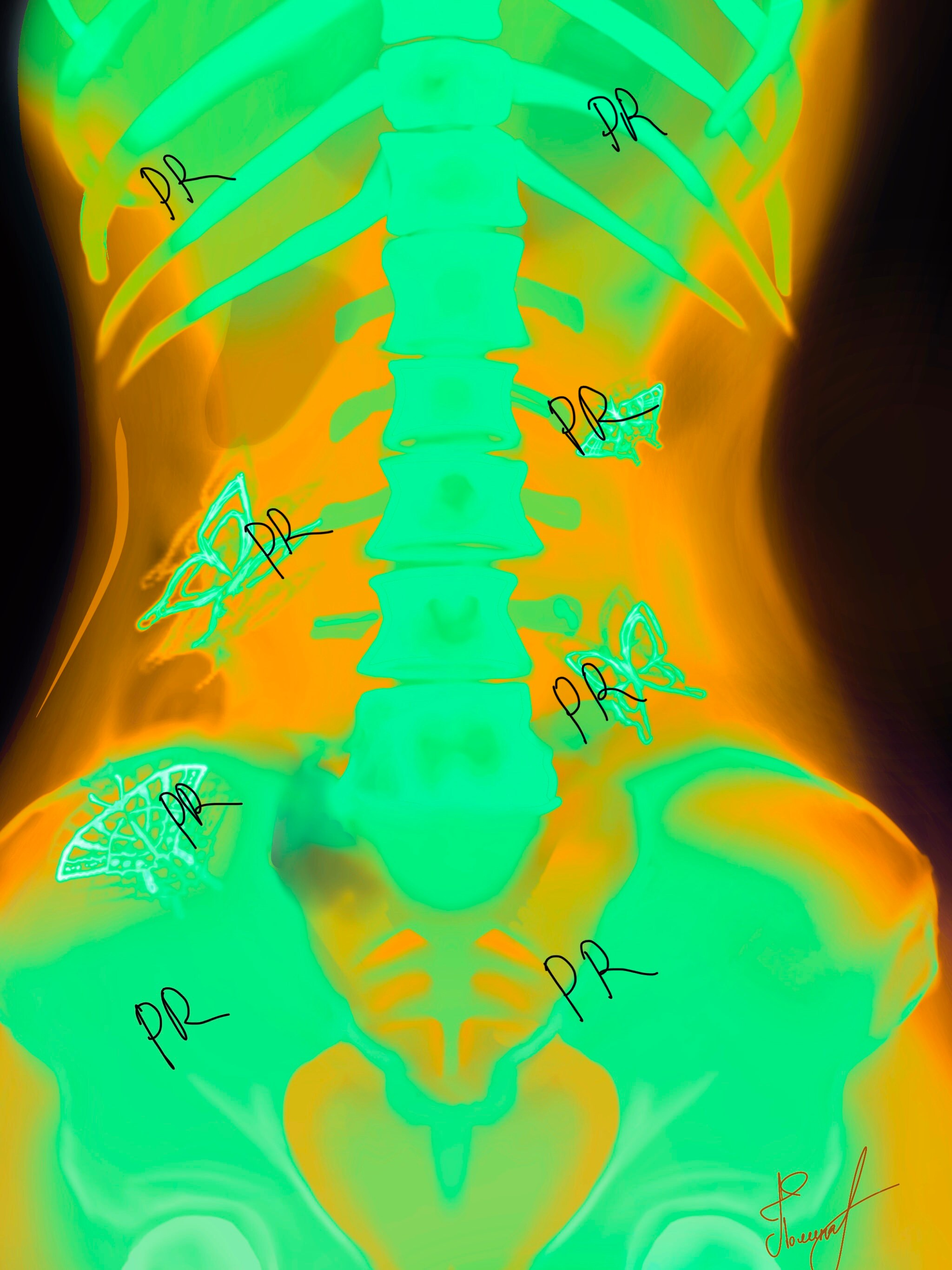 絵画 In my stomach Butterflies In My Stomach High-Res Vector Graphic - Getty Images