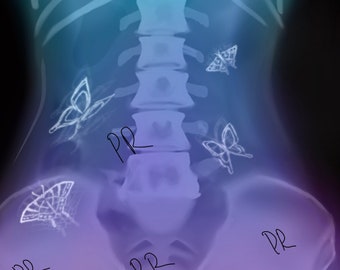 絵画 In my stomach stomach organ pain illustration - Stock Illustration