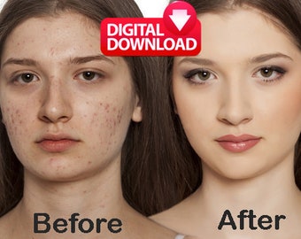 Remove Pimple, Acne, Blemishes Scars and Make Skin Smooth from Pictures. Remove Face Lesions and Tags from Photos. Skin Retouching.Skin Care