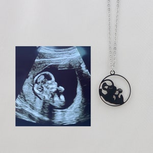 Custom Pregnancy Scan Necklace, Personalized Sonogram Ultrasound Jewelry, Birthday Gift for New Dad, Memorial Gift for Dad/Daddy/Mom