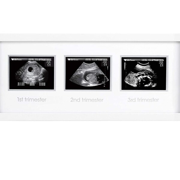 Ultrasound Frame Etsy