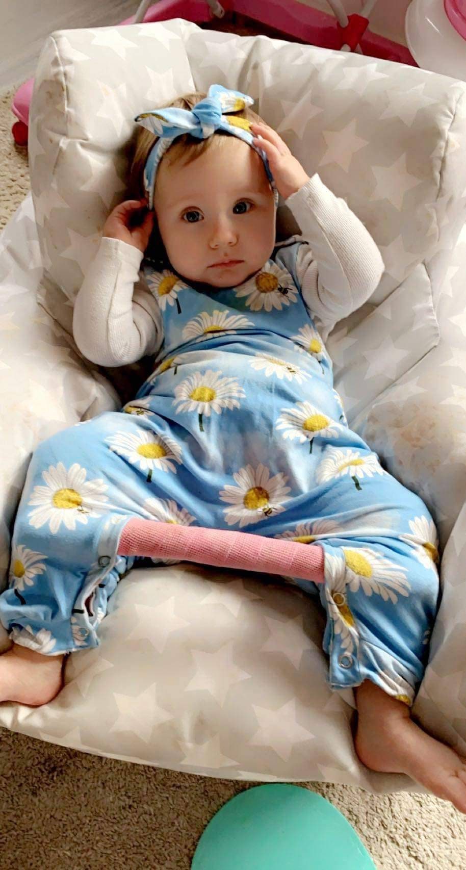 Spica Romper for Use With Spica Cast Hip Brace Hip Etsy UK