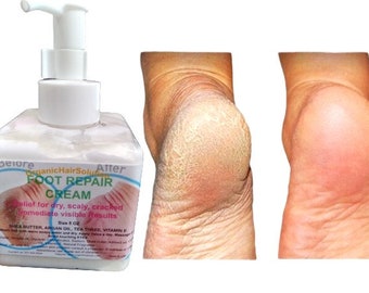 CREMA RIPARATRICE PER PIEDI - per piedi secchi e screpolati, piede d'atleta, funghi alle unghie, prurito, tigna, talloni screpolati e pelle pruriginosa