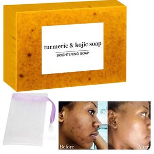 Turmeric Kojic Acid Glow Dark Spot,  Even Skin Tone,  Deep Cleansing