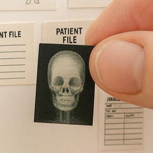 Printable 1:12 Scale Medical Charts, Patient Files & X-Rays, Dollhouse Miniature Doctor’s Office Accessories Doctor Hospital Files PRINTABLE