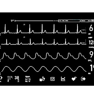 Cardiac Monitor Original Grafik PNG, SVG & JPEG Digital Download Lizenz kostenlos
