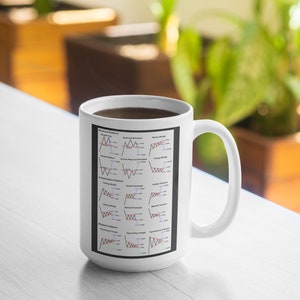 May include: White ceramic mug with a black graphic of different stock market chart patterns. The patterns are labeled with their names, such as "Double Top", "Head and Shoulders", and "Rising Wedge".