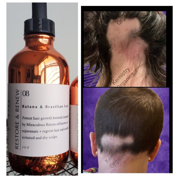 BATANA Mega Grow Herbal Cold Pressed Hair Growth Oil   Scalp Stimulating Deep Penetrating Hair Restorer 50 Ingredients