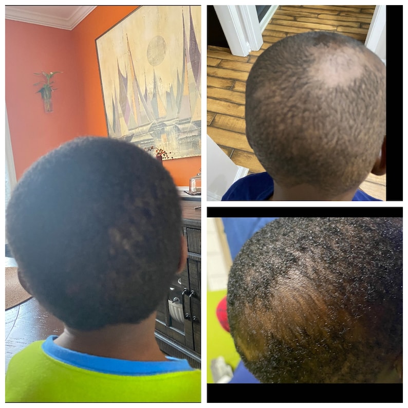 childs hair growth results