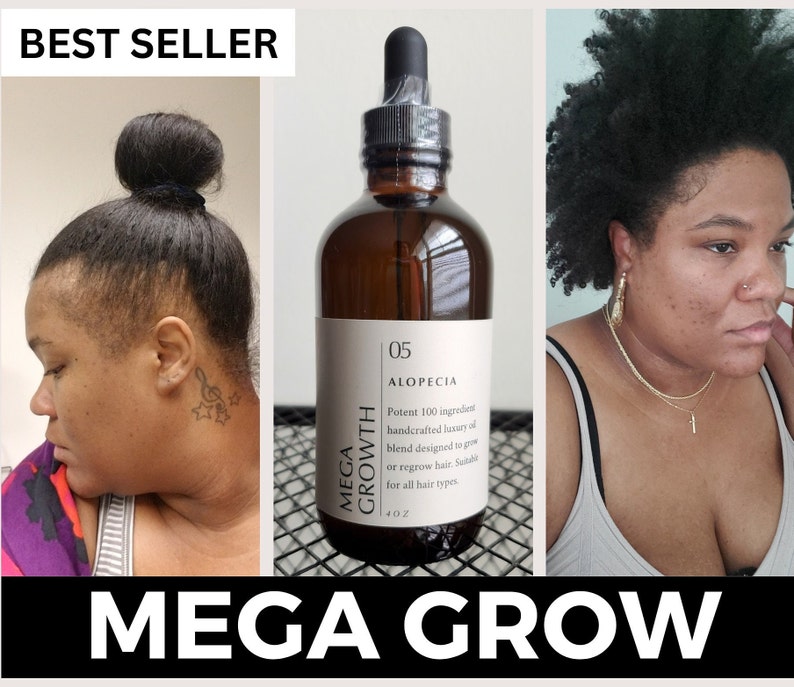 Peut inclure: Une bouteille en verre brun avec un compte-gouttes &eacute;tiquet&eacute; "05 Alopecia Mega Growth" et le texte "Potent 100 ingredient handcrafted luxury oil blend designed to grow or regrow hair. Suitable for all hair types 4 oz".