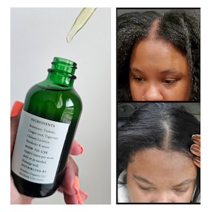 ROSEMARY TRIPLE Strength 40 Ingredient Growth Oil Follicle Activating/Stimulating DHT Blocking Fast Acting